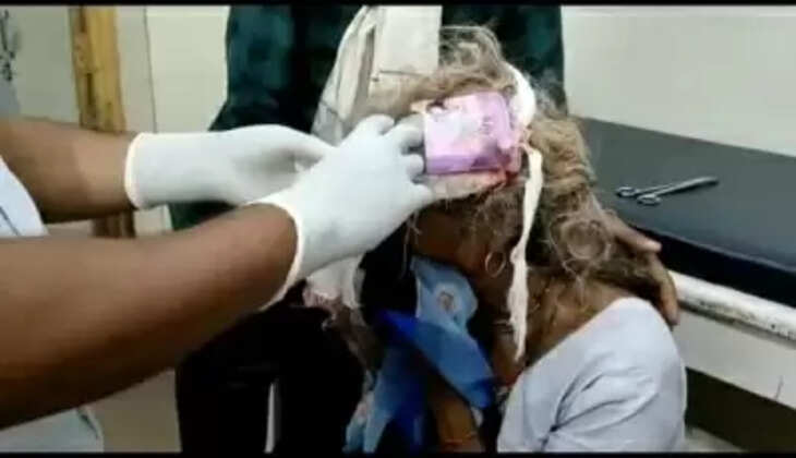 मप्र : सामुदायिक स्वास्थ्य केंद्र पर कंडोम के पैकेट से महिला के सिर के घाव की मरहमपट्टी