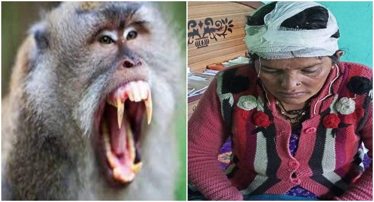 गरमपानी-बंदर ने आंगनबाड़ी कार्यकर्ता का कर दिया ये हाल, गुलदार के बाद अब बंदरों का आतंक