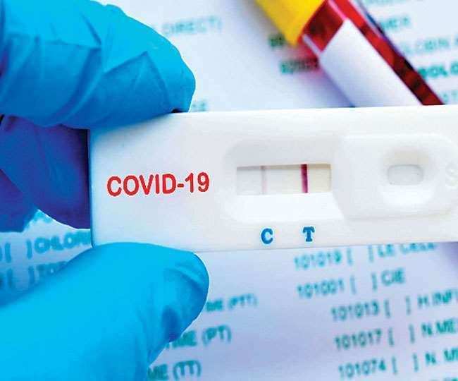 देहरादून- अब मात्र इतने रूपये में होगा कोविड-19 एंटीजन टेस्ट, सरकार ने जारी किया आदेश