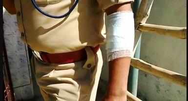 BAREILLY BREAKING: लॉकडाउन का पालन कराने गई पुलिस टीम पर भीड़ का हमला, आईपीएस अफसर घायल