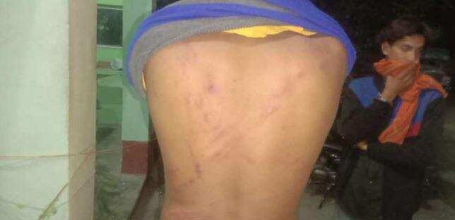 हल्द्वानी-प्रेमिका से मिलने गये प्रेमी का भाइयों ने कर दिया ये हाल, 108 की मदद से पहुंचा अस्पताल