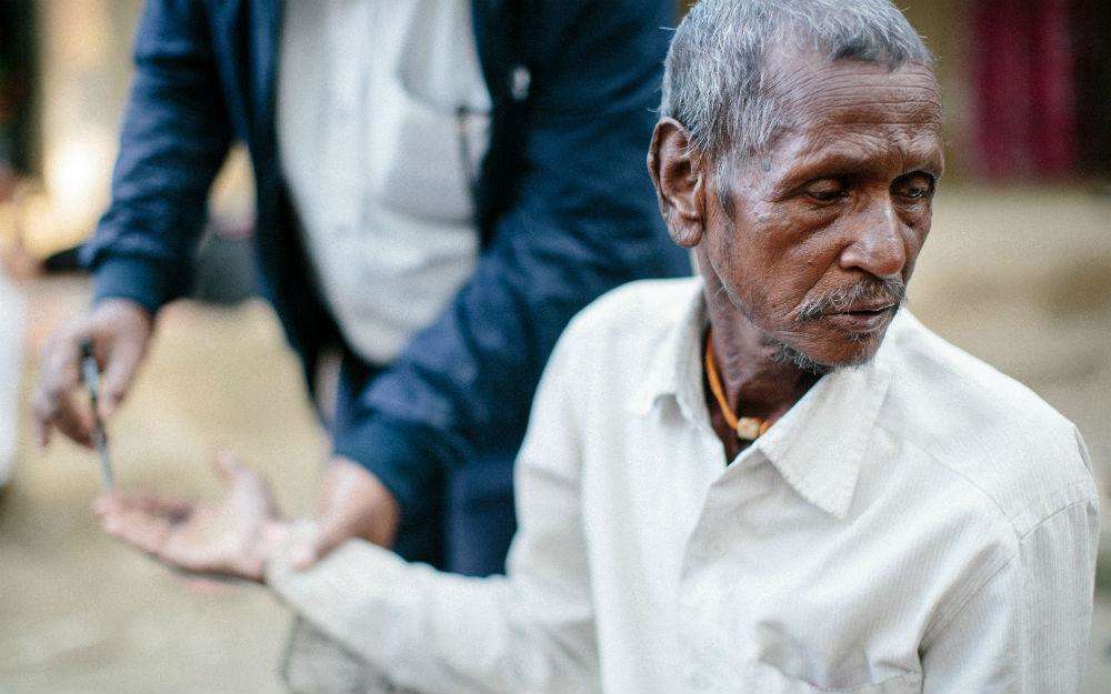 World Leprosy Day 2021 जानें  क्या है लेप्रोसी , देखें क्या है इसका इलाज़ और लक्षण
