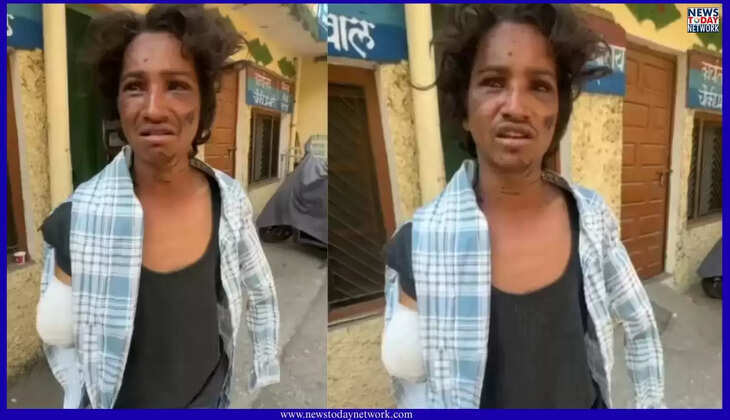 उत्तराखंड - भाई और भाभी ने दिया जिंदगी भर का जख्म, अंग्रेज को गवांने पड़े अपने दोनों हाथ, पति- पत्नी को किया गिरफ्तार&nbsp;