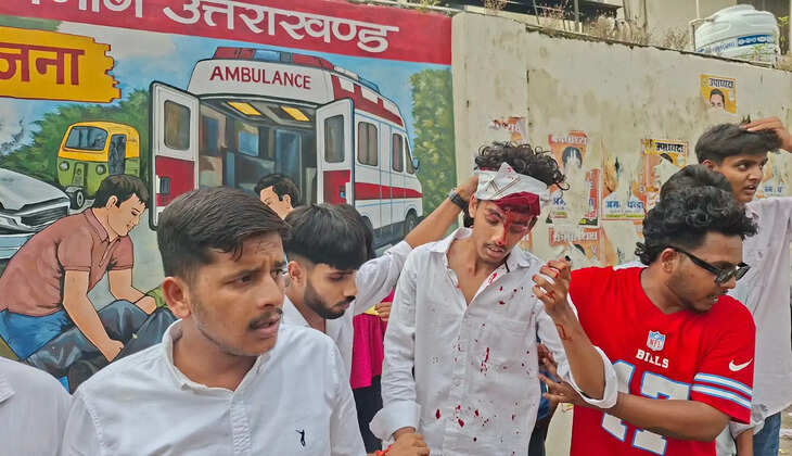 हल्द्वानी - MBPG कॉलेज छात्रसंघ चुनाव में बवाल, नैनीताल रोड पर भिड़े छात्र गुट, युवक का सर फोड़ा&nbsp;