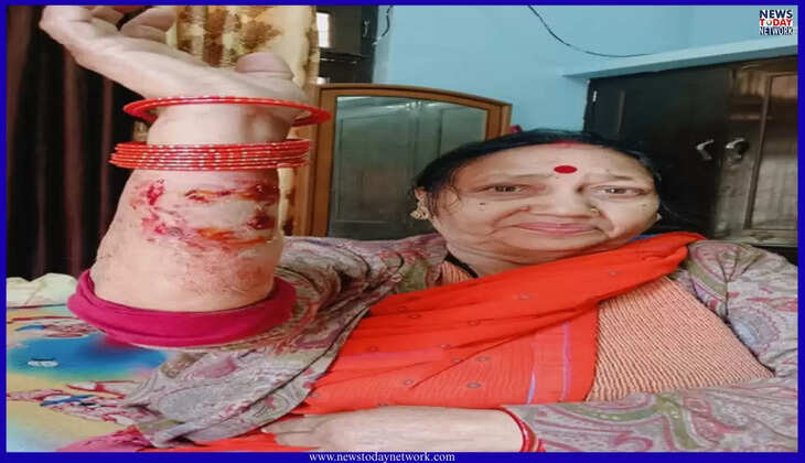 हल्द्वानी - शहर में लावारिस कुत्तों का आतंक, पार्षद के भाई समेत 15 लोग घायल, किसी की नाक तो किसी के हाथ नोंचे&nbsp;