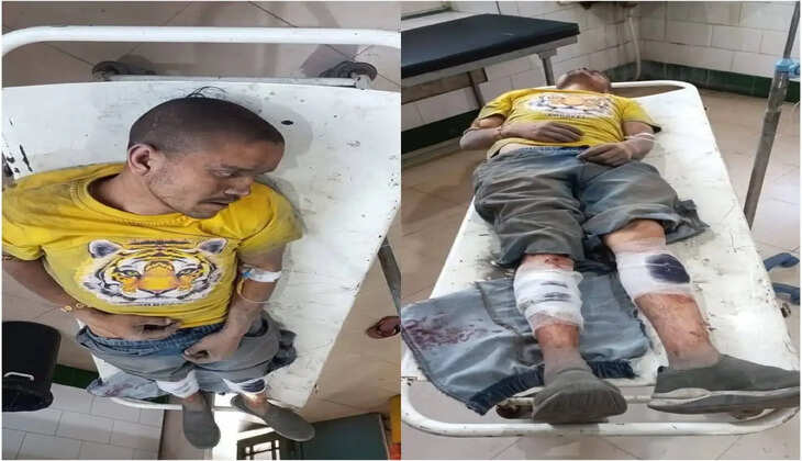 काशीपुर - यूट्यूबर बिरजू मयाल के साथ मारपीट, घायल मयाल बोला मेरी वीडियो बना लो नहीं तो...