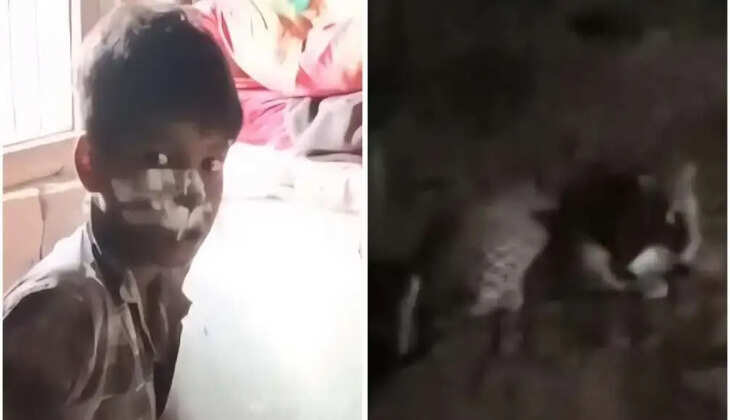 हल्द्वानी - दहशत, 10 वर्षीय किशोर पर झपटा गुलदार, ठंड बढ़ने के साथ बढ़ता जाएगा वन्यजीव का आतंक&nbsp;