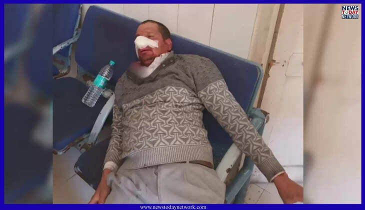 नैनीताल - बोट स्टैंड पर दो नाव चालकों में जमकर मारपीट, एक की नाक टूटी अस्पताल में भर्ती