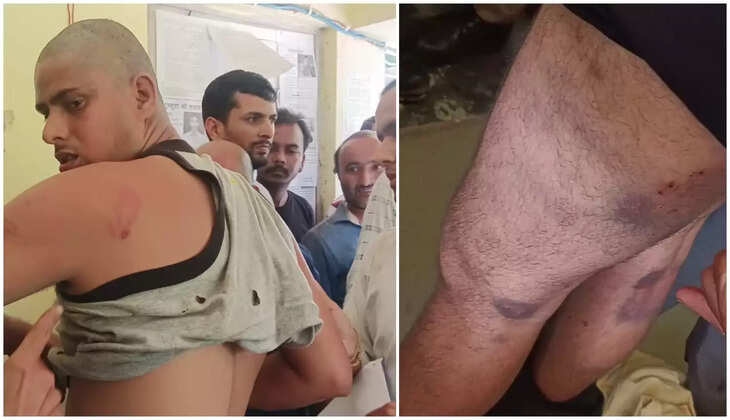 ओखलकांडा - फेरी वाले से मनमोहन ने पूछा सत्यापन है, SI शादिक हुसैन ने कर दी जमकर मारपीट, क्षेत्र में आक्रोश&nbsp;